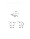 Analyte Sensor diagram and image