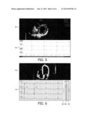 INTEGRATED DISPLAY OF ULTRASOUND IMAGES AND ECG DATA diagram and image