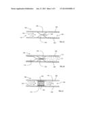 APPARATUS TO PREVENT REPURFUSION INJURY diagram and image