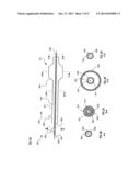 APPARATUS TO PREVENT REPURFUSION INJURY diagram and image