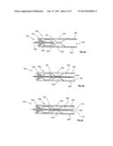 APPARATUS TO PREVENT REPURFUSION INJURY diagram and image