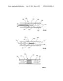 APPARATUS TO PREVENT REPURFUSION INJURY diagram and image