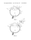 FLUID EXCHANGE APPARATUS AND METHODS diagram and image