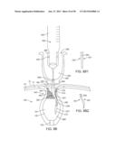 FLUID EXCHANGE APPARATUS AND METHODS diagram and image