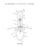 FLUID EXCHANGE APPARATUS AND METHODS diagram and image