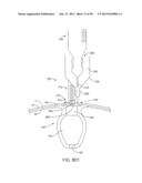 FLUID EXCHANGE APPARATUS AND METHODS diagram and image