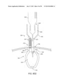 FLUID EXCHANGE APPARATUS AND METHODS diagram and image