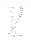 FLUID EXCHANGE APPARATUS AND METHODS diagram and image