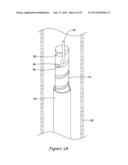 NERVE MODULATION SYSTEM HAVING HELICAL GUIDE diagram and image