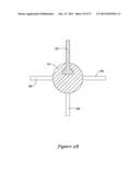 NERVE MODULATION SYSTEM HAVING HELICAL GUIDE diagram and image