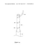 NERVE MODULATION SYSTEM HAVING HELICAL GUIDE diagram and image