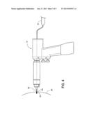 SURGICAL NAVIGATION diagram and image