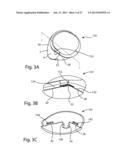 Patient Specific Implants and Instrumentation For Patellar Prostheses diagram and image