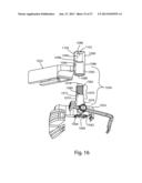 Patient Specific Implants and Instrumentation For Patellar Prostheses diagram and image