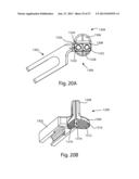 Patient Specific Implants and Instrumentation For Patellar Prostheses diagram and image