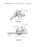 Patient Specific Implants and Instrumentation For Patellar Prostheses diagram and image