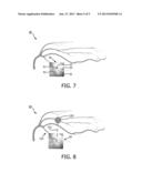 ROBOTIC CONTROL OF AN ENDOSCOPE FROM BLOOD VESSEL TREE IMAGES diagram and image