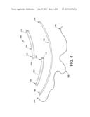 SURGICAL DEVICE, METHOD OF PERFORMING SURGERY USING SAME, AND SURGICAL     DEVICE KIT diagram and image