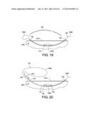 SURGICAL DEVICE, METHOD OF PERFORMING SURGERY USING SAME, AND SURGICAL     DEVICE KIT diagram and image