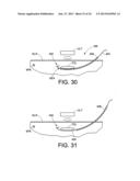 SURGICAL DEVICE, METHOD OF PERFORMING SURGERY USING SAME, AND SURGICAL     DEVICE KIT diagram and image