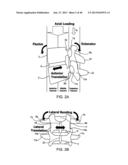 SYSTEMS AND METHODS FOR POSTERIOR DYNAMIC STABILIZATION OF THE SPINE diagram and image