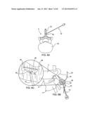 SYSTEMS AND METHODS FOR POSTERIOR DYNAMIC STABILIZATION OF THE SPINE diagram and image