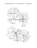 SYSTEMS AND METHODS FOR POSTERIOR DYNAMIC STABILIZATION OF THE SPINE diagram and image