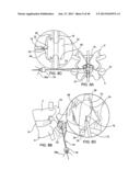 SYSTEMS AND METHODS FOR POSTERIOR DYNAMIC STABILIZATION OF THE SPINE diagram and image