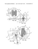 SYSTEMS AND METHODS FOR POSTERIOR DYNAMIC STABILIZATION OF THE SPINE diagram and image