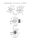 SYSTEMS AND METHODS FOR POSTERIOR DYNAMIC STABILIZATION OF THE SPINE diagram and image