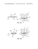 SYSTEMS AND METHODS FOR POSTERIOR DYNAMIC STABILIZATION OF THE SPINE diagram and image