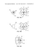 SYSTEMS AND METHODS FOR POSTERIOR DYNAMIC STABILIZATION OF THE SPINE diagram and image