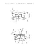 SYSTEMS AND METHODS FOR POSTERIOR DYNAMIC STABILIZATION OF THE SPINE diagram and image