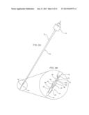 SYSTEMS AND METHODS FOR POSTERIOR DYNAMIC STABILIZATION OF THE SPINE diagram and image