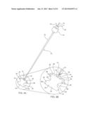 SYSTEMS AND METHODS FOR POSTERIOR DYNAMIC STABILIZATION OF THE SPINE diagram and image