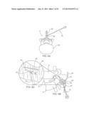 SYSTEMS AND METHODS FOR POSTERIOR DYNAMIC STABILIZATION OF THE SPINE diagram and image