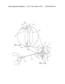 SYSTEMS AND METHODS FOR POSTERIOR DYNAMIC STABILIZATION OF THE SPINE diagram and image