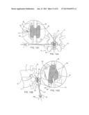 SYSTEMS AND METHODS FOR POSTERIOR DYNAMIC STABILIZATION OF THE SPINE diagram and image