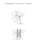 SYSTEMS AND METHODS FOR POSTERIOR DYNAMIC STABILIZATION OF THE SPINE diagram and image