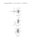 SYSTEMS AND METHODS FOR POSTERIOR DYNAMIC STABILIZATION OF THE SPINE diagram and image