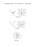 SYSTEMS AND METHODS FOR POSTERIOR DYNAMIC STABILIZATION OF THE SPINE diagram and image