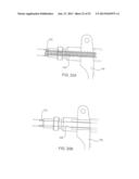 SYSTEMS AND METHODS FOR POSTERIOR DYNAMIC STABILIZATION OF THE SPINE diagram and image