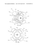 SYSTEMS AND METHODS FOR POSTERIOR DYNAMIC STABILIZATION OF THE SPINE diagram and image