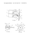 SYSTEMS AND METHODS FOR POSTERIOR DYNAMIC STABILIZATION OF THE SPINE diagram and image