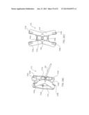 SYSTEMS AND METHODS FOR POSTERIOR DYNAMIC STABILIZATION OF THE SPINE diagram and image