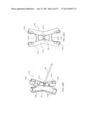 SYSTEMS AND METHODS FOR POSTERIOR DYNAMIC STABILIZATION OF THE SPINE diagram and image