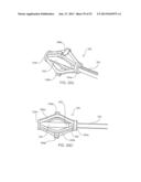 SYSTEMS AND METHODS FOR POSTERIOR DYNAMIC STABILIZATION OF THE SPINE diagram and image