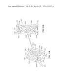 SYSTEMS AND METHODS FOR POSTERIOR DYNAMIC STABILIZATION OF THE SPINE diagram and image