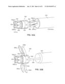 SYSTEMS AND METHODS FOR POSTERIOR DYNAMIC STABILIZATION OF THE SPINE diagram and image