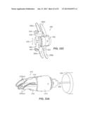 SYSTEMS AND METHODS FOR POSTERIOR DYNAMIC STABILIZATION OF THE SPINE diagram and image